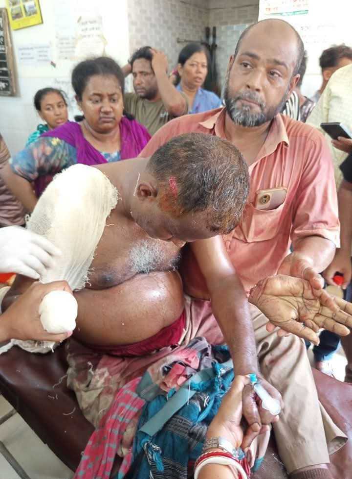 কাশিপুর ইউনিয়নের সারুলিয়া গ্রামের বিএনপি’র সভাপতি এর কব্জি কত্তন। 